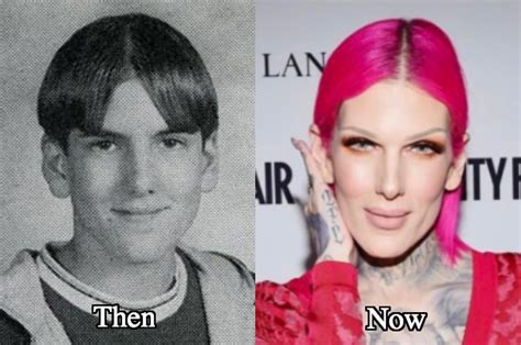 jeffree star|jeffree star before surgery.